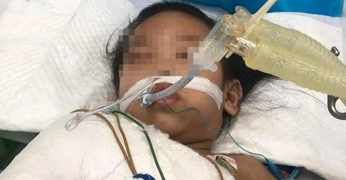 Quặn lòng trước những hình ảnh thập tử nhất sinh của bé gái 3 tuổi bị đóng 9 chiếc đinh vào đầu